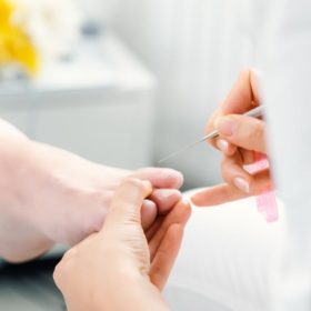 lấy khóa móng chân nhiều lần