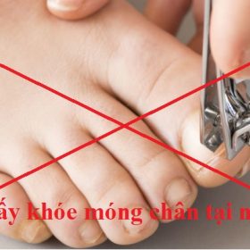 lấy khóe móng chân tại nhà