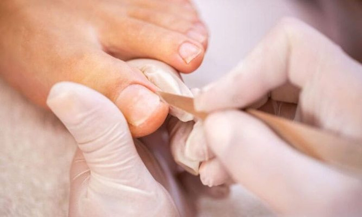 Thực hiện tiểu phẫu tại các cơ sở uy tín, đảm bảo