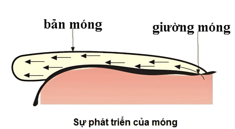 Nếu tình trạng tái phát trên cùng một ngón chân sẽ cắt bỏ một phần móng cùng với giường móng