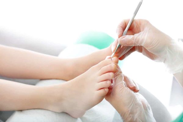 Cách lấy khóe móng chân an toàn hiệu quả