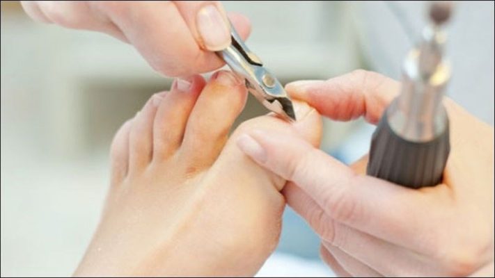 Cách cắt khóe chân an toàn, đơn giản tại nhà