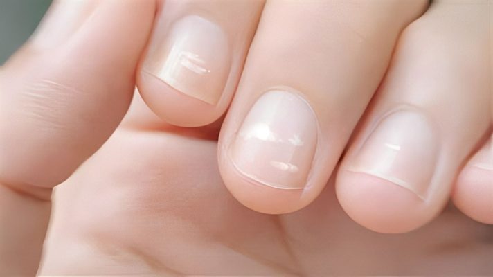 Móng tay xuất hiện đốm trắng là bệnh gì?