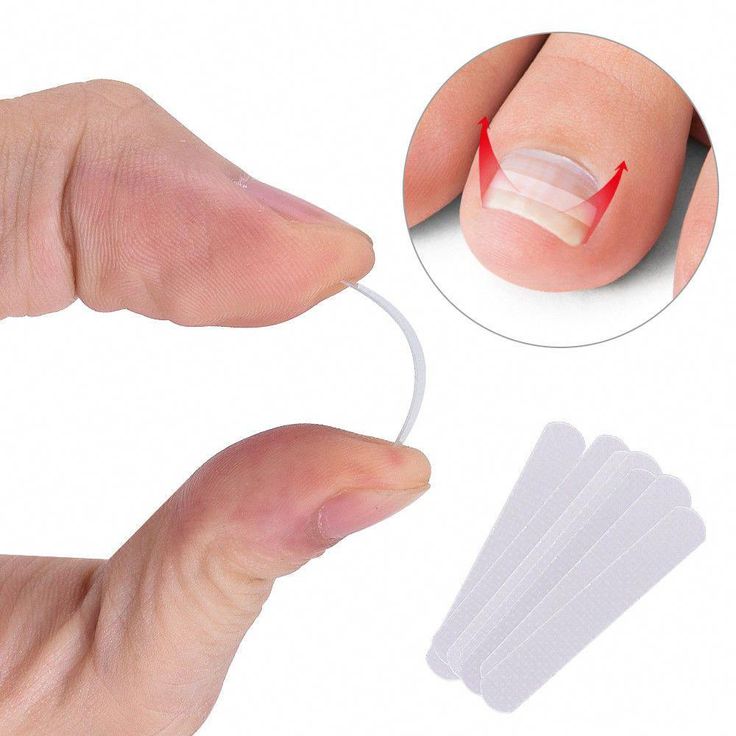 Trong 48 giờ đầu tiên, bạn tuyệt đối không nên để móng chân bị tách khỏi thịt tiếp xúc với nước