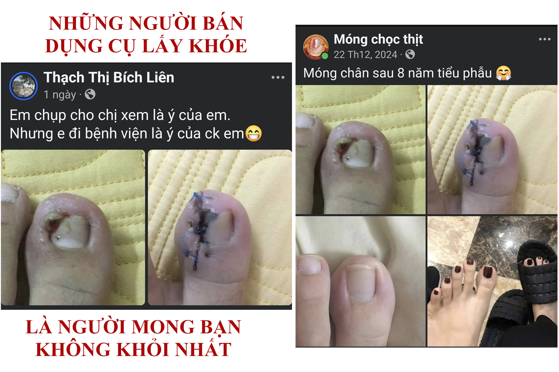 Hiện tại có nhiều cơ sở nhận lấy khóe móng chân điều trị móng chọc thịt