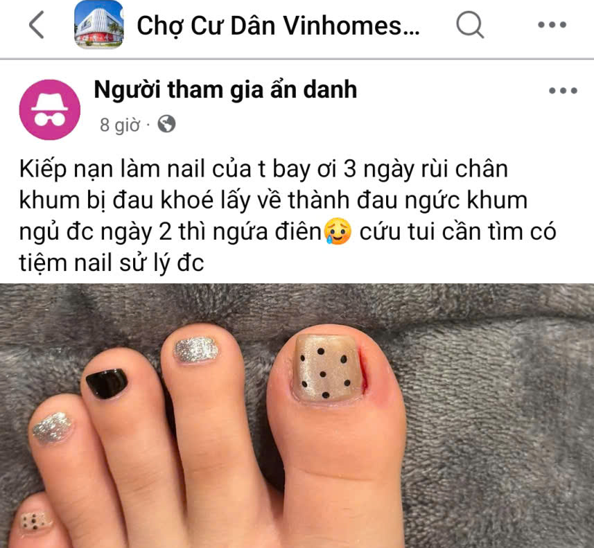 Từ trước đến nay, mọi người cứ nghĩ móng chân, móng tay không thể ảnh hưởng đến sức khỏe của bản thân